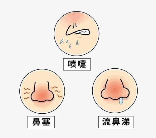 家长莫慌!你想知道的都在这