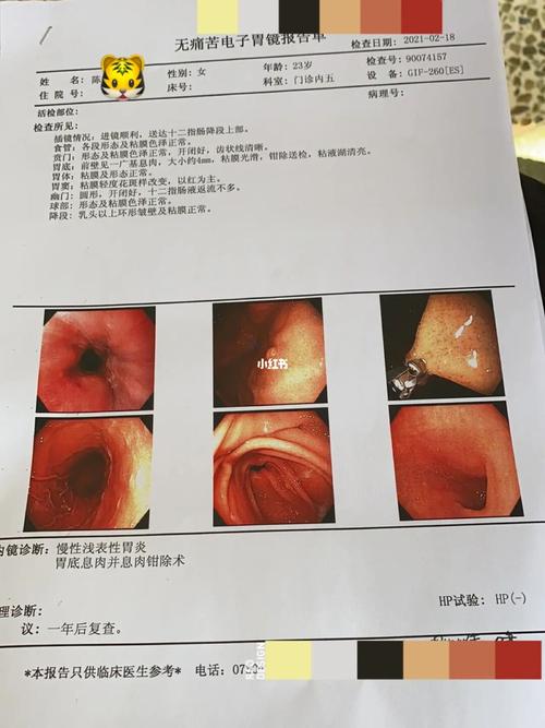 慢性浅表性胃炎_胃炎_胃病_炸鸡_养胃_奶茶_p图_熬夜