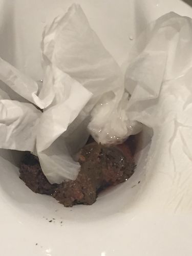 今天早上大便然后发现大便有部分是微红色的大便的时候有刺痛