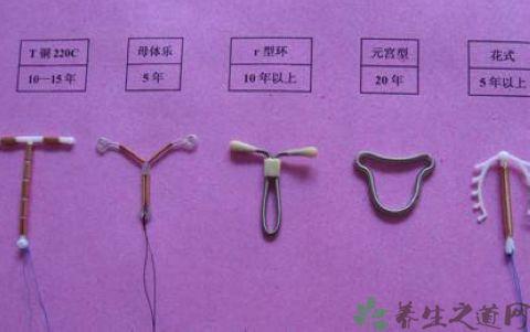 上避孕环必知20个注意事项