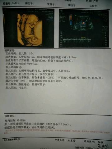 育儿问答 怀孕期 各位亲爱的宝妈,你们能看出我怀的是男宝宝还是女