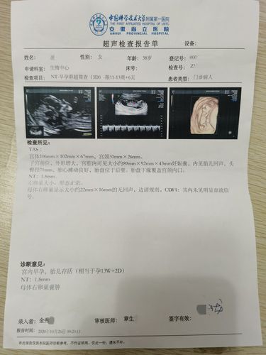 怀孕13周 2天,超声波检查结果报告单,是否正常?