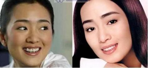 揭秘明星牙齿整形档案(图)