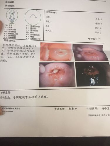 26岁,未生育,宫颈糜烂,同房出血,以下是检验报告,严重
