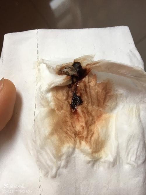 二宝怀孕46天,检查像35天,有褐色分泌物,今天第二天有