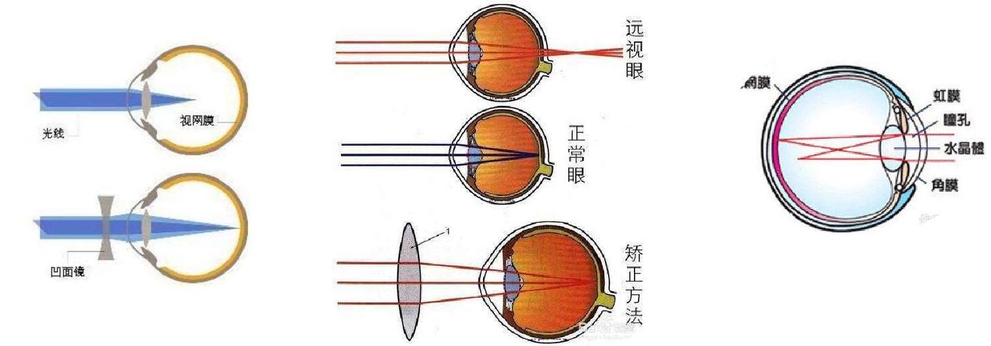 近视,远视以及散光的原理