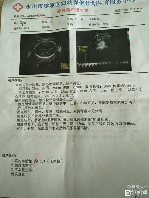 胎心率看性别准吗