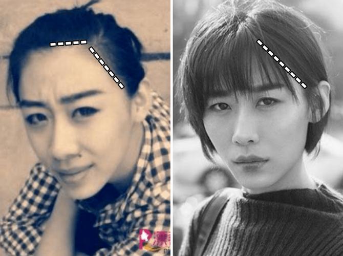 4种菱形脸的变美思路_颧骨