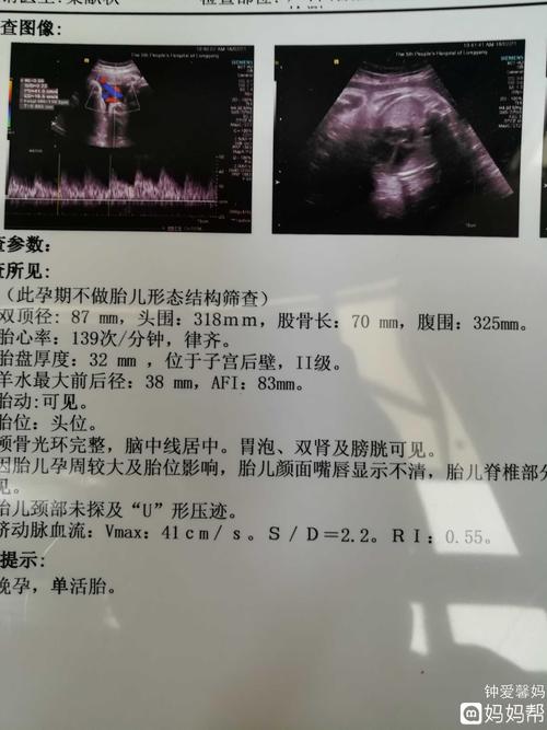 宝宝有多大? - 2018年3月出生帮 - 妈妈帮