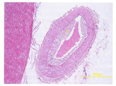 图4-9  心脏左冠状动脉旋支切片,he染色五指山小型猪高胆固醇高脂饲料