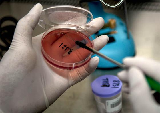 细菌接种实验方法