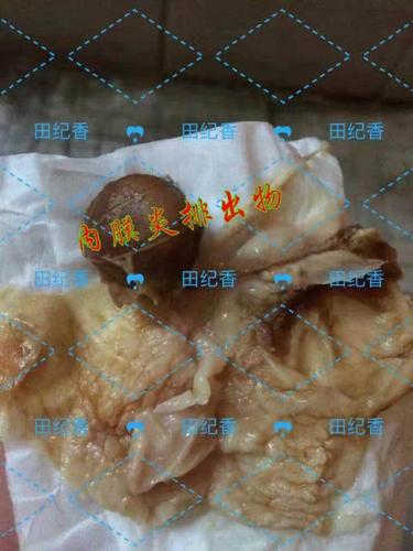 内膜炎】 写美篇子宫息肉会排出烂肉样东西, 子宫黏连排出湿寒物体