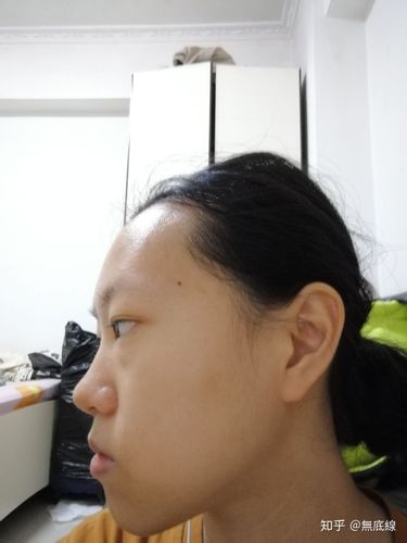 月亮脸?鞋拔子脸?是不是很丑?
