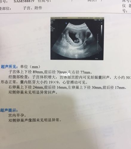 我倒是希望是个女孩,因为一胎已经有男宝了,来个女宝就儿女双全