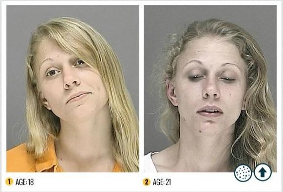 美反吸毒机构展示吸毒者溃烂面容 教育年轻人(组图)