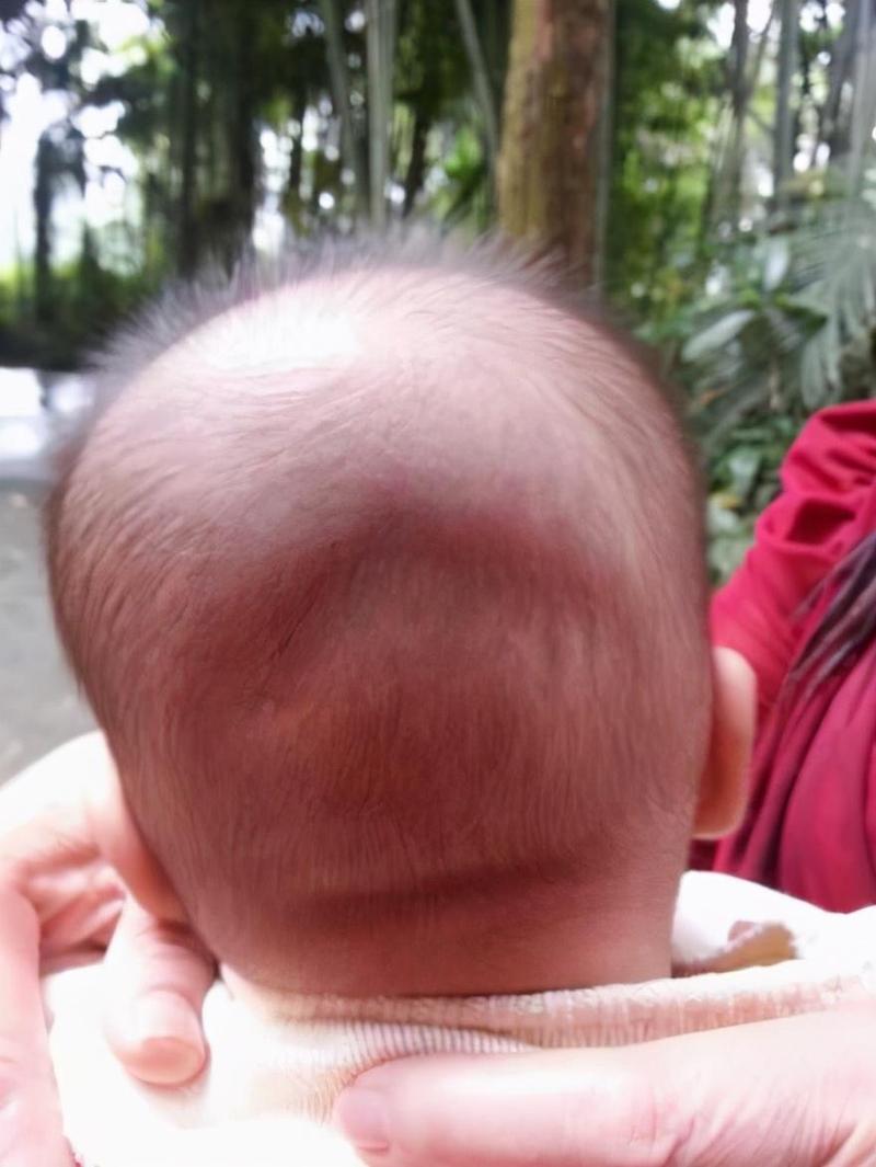 原创宝宝"小脑袋瓜"不能随便摸,会影响孩子智力?囟门真那么脆弱?