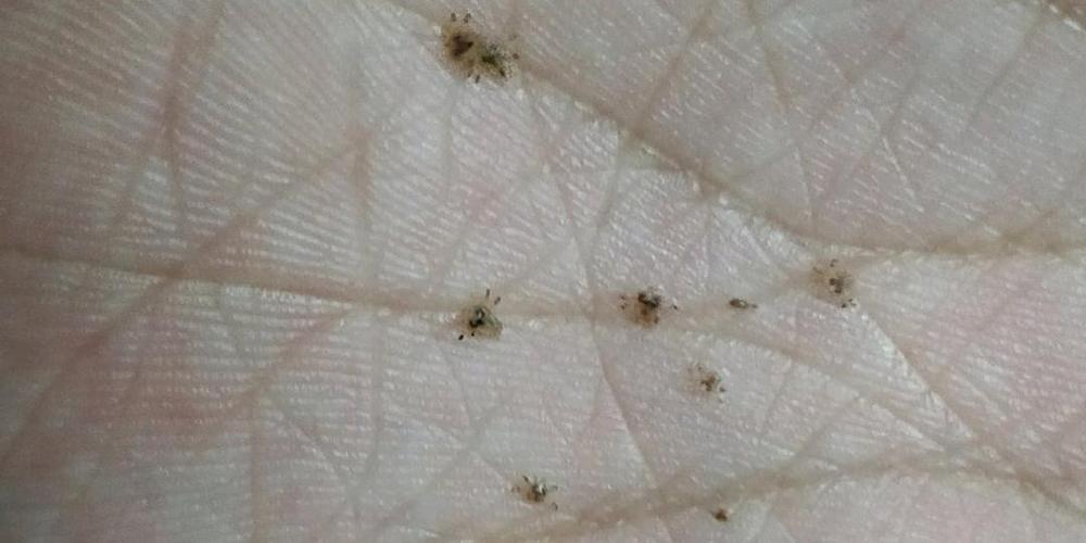 你们有过得阴虱的经历吗?