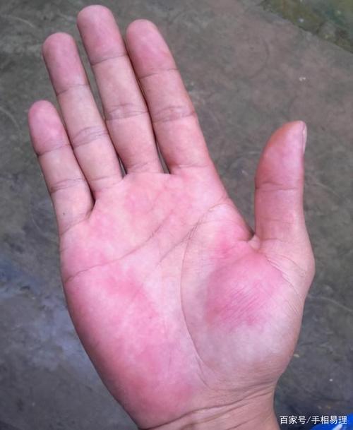 手掌红润饱满
