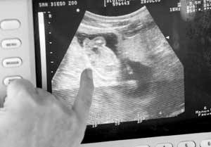 旅美大熊猫白云怀上双胞胎 预产期在下个月(图)