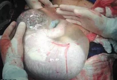 为什么叫"羊水",和羊有啥关系?