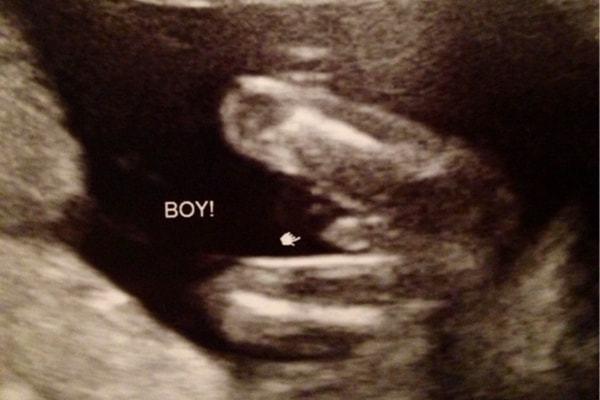 通过四维可以清晰看到的胎儿性别照片您懂了吗