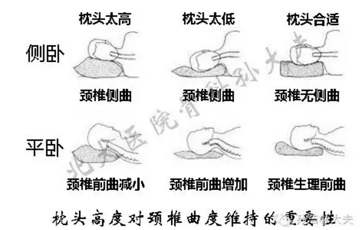 常见问答:(五)颈椎生理曲度变直怎么办?