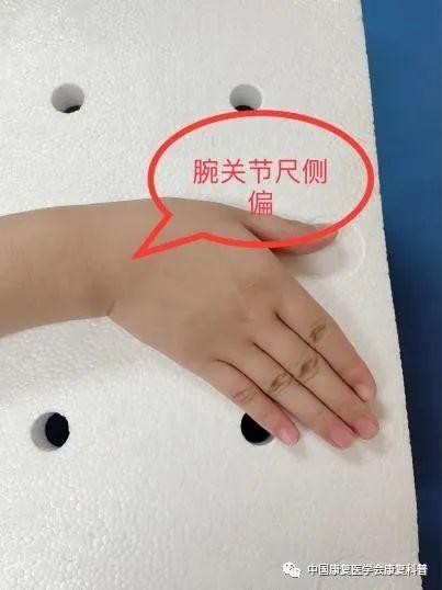 尺侧偏与桡侧偏,向手的拇指和小指侧活动手腕,在最大程度坚持5秒