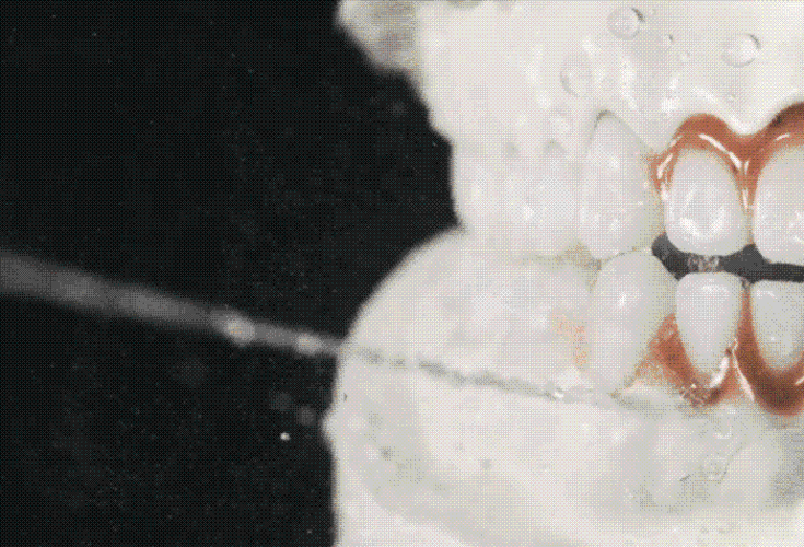 即使我们刷牙后饮用咖啡,茶等有色饮品,牙齿也不会染成茶渍牙,咖啡牙