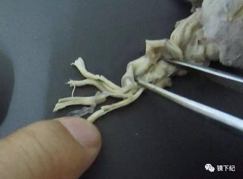 神经断了 手术接上会怎么样呢?