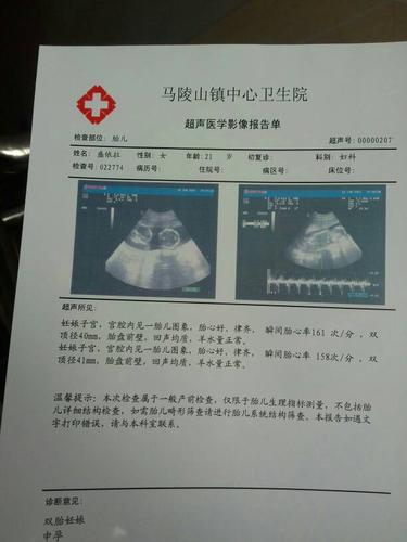 是单绒单羊还是双绒双羊?谢谢