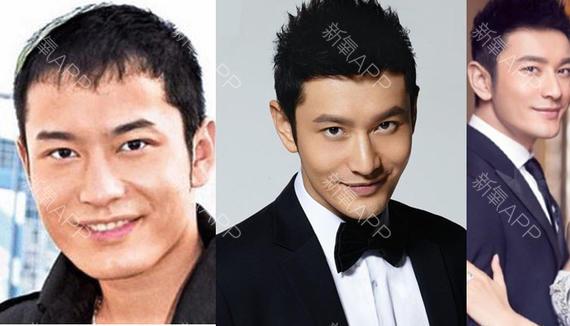 【韩国korea整形医院】黄晓明baby杨幂 有多少明星下巴动刀?