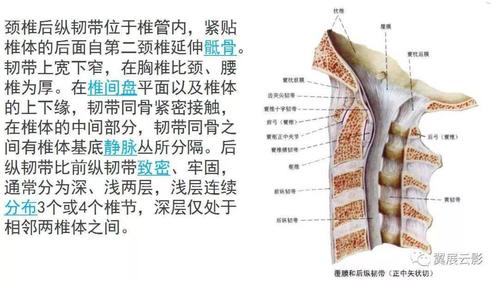 颈椎后纵韧带骨化症(opll)x线诊断