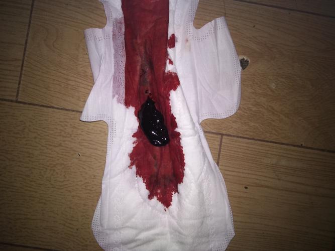 我今天药流,但是不知道流出来的