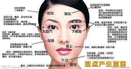 眼角长了块斑是怎么回事