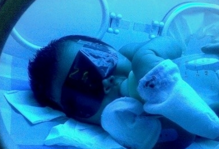 新生儿黄疸照蓝光费用是多少 新生儿黄疸照蓝光多久能