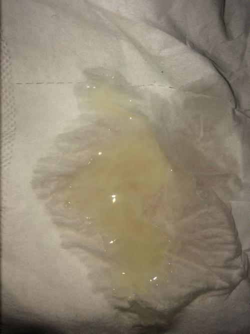 上海长海医院检查精子活跃度 成活率大概多个费用 还有这个正常不