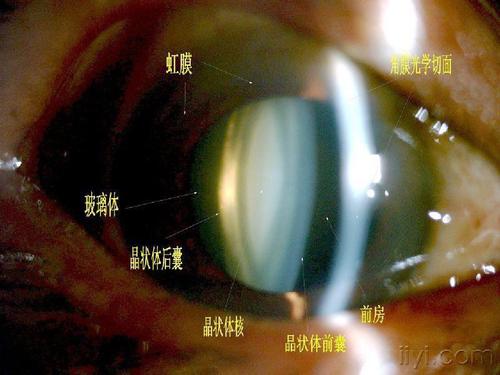 裂隙灯的使用ppt