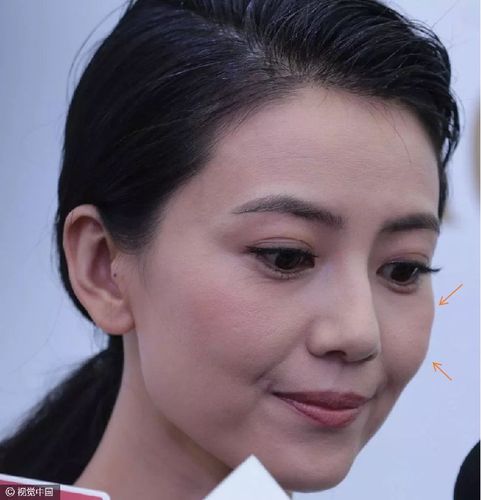 你对苹果肌的误解,都在这里了!