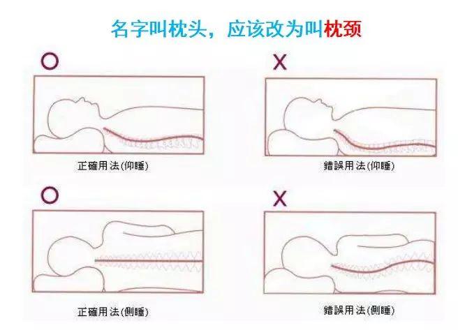 颈椎生理曲度变直怎么治疗