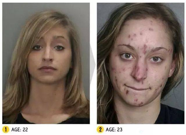 禁毒科普 | 如何辨别身边人是否吸毒?