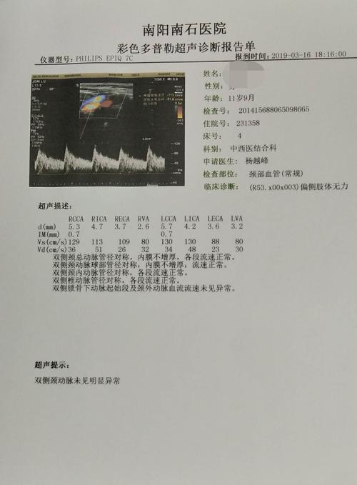 主管医生申请颈动脉超声检查,排除大动脉炎.