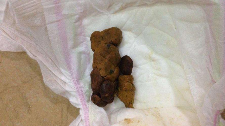 粪便,俗称"大便","屎","便便",""等,是人或动物的大肠排遗物.