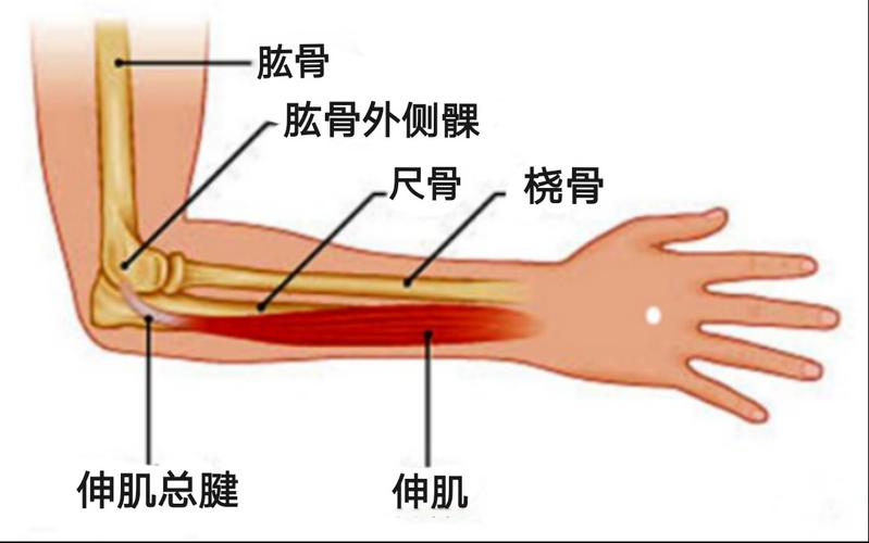 肘部疼痛,拧毛巾困难,可能"网球肘"缠上!
