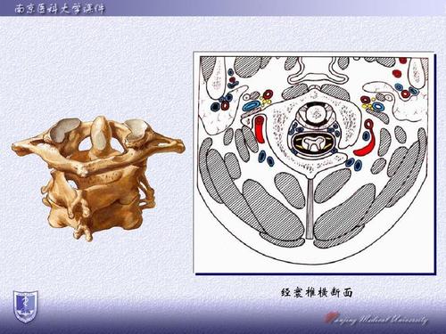经寰椎横断面