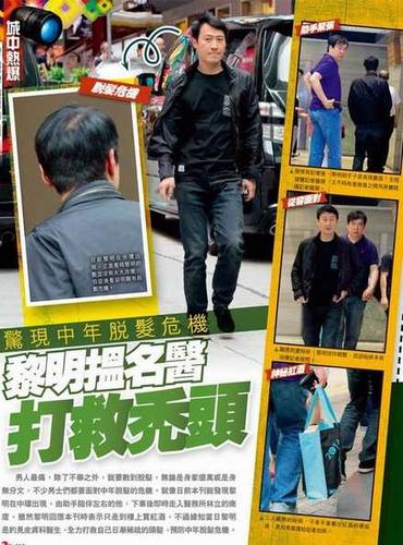 黎明头发日渐稀疏疑寻名医预防脱发危机