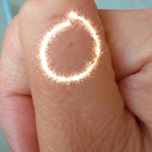 被仓鼠咬破了点皮,已经用酒精消毒了,会不会有什么大问题啊?用打针吗?