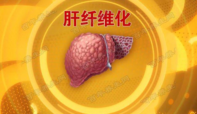 20160705养生堂视频和笔记:孟庆华,蒋峰,肝纤维化,肝硬化,脂肪肝