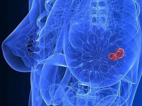 专家提醒,乳腺出现这样的改变一定要警惕!