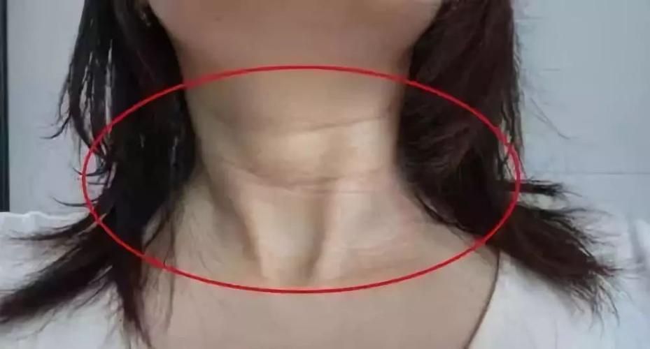 露脖子的季节到了你的颈纹还没消这支便宜疯的颈部小熨斗每天不到2块