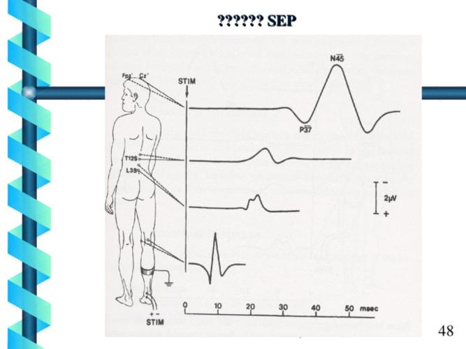 肌电图和脑诱发电位